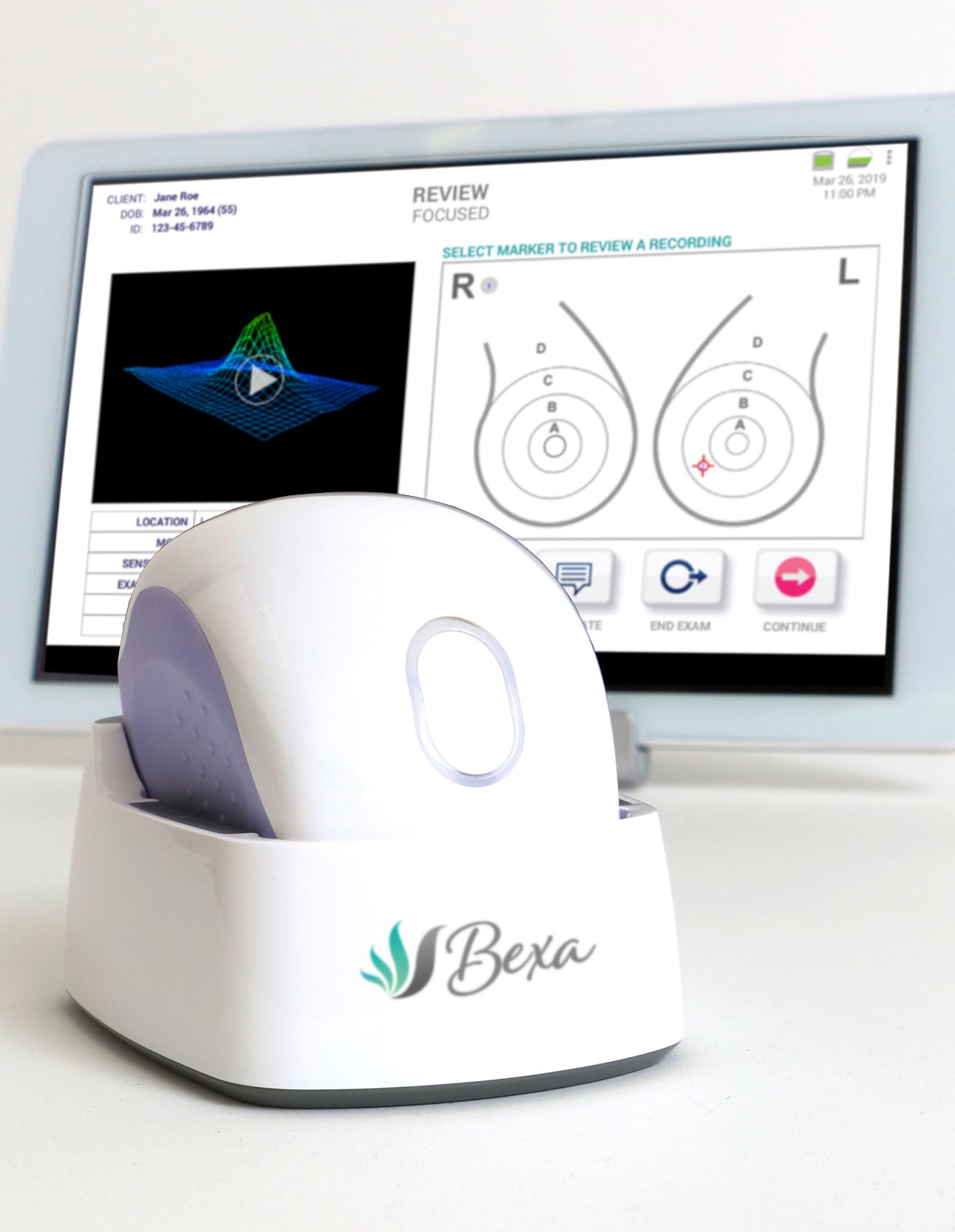 bexa device